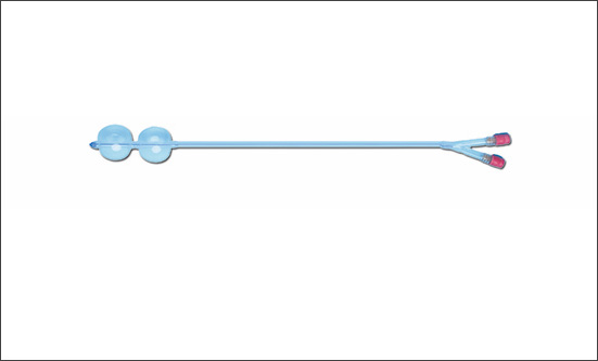 孕產(chǎn)安全無小事，子宮頸擴張球囊導管超可靠